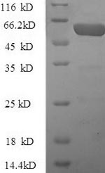 Recombinant Human Pregnancy zone protein(PZP),partial