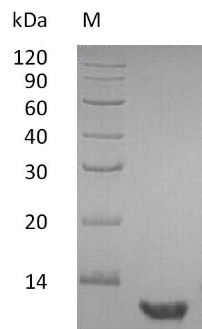 Recombinant Human Pro-epidermal growth factor(EGF),partial (Active)