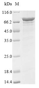 Recombinant Human Probable ATP-dependent RNA helicase DDX5(DDX5)