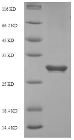 Recombinant Human Programmed cell death protein 1(PDCD1),partial