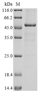 Recombinant Human Prolactin regulatory element-binding protein(PREB),partial
