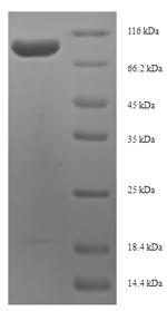 Recombinant Human Proliferation marker protein Ki-67(MKI67),partial
