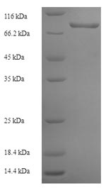 Recombinant Human Prolyl 4-hydroxylase subunit alpha-3(P4HA3)