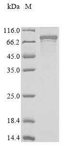 Recombinant Human Protein CBFA2T1(RUNX1T1)