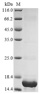 Recombinant Human Protein DEK(DEK) (S375SLEH),partial