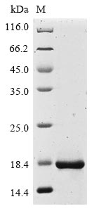 Recombinant Human Protein IL-40(C17orf99)