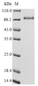 Recombinant Human Protein Mdm4(MDM4)