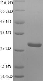 Recombinant Human Protein S100-A4(S100A4)