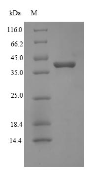 Recombinant Human Protein Wnt-2(WNT2) 