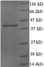 Recombinant Human Protein Wnt-3a(WNT3A),partial