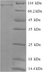 Recombinant Human Protein-arginine deiminase type-2(PADI2)