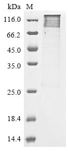 Recombinant Human Protein-arginine deiminase type-2(PADI2)