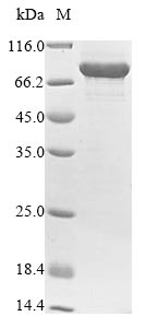 Recombinant Human Protein-arginine deiminase type-4(PADI4)