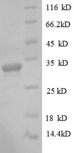 Recombinant Human Protein delta homolog 1(DLK1),partial
