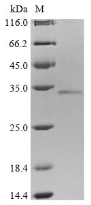 Recombinant Human Protein mono-ADP-ribosyltransferase PARP9(PARP9),partial