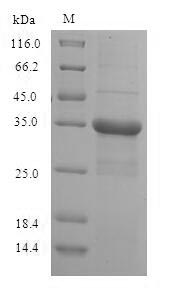 Recombinant Human Putative 40S ribosomal protein S10-like(RPS10P5)