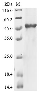 Recombinant Human Putative pregnancy-specific beta-1-glycoprotein 7(PSG7)