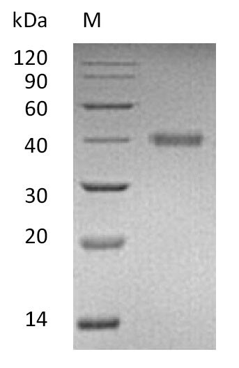 Recombinant Human R-spondin-1(RSPO1),partial (Active)