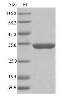 Recombinant Human RNA-binding motif protein, X chromosome(RBMX),partial