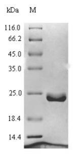 Recombinant Human Ragulator complex protein LAMTOR1(LAMTOR1)