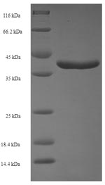 Recombinant Human Ras-related protein Rab-11A(RAB11A)