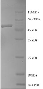 Recombinant Human Ras-related protein Rab-1A(RAB1A)