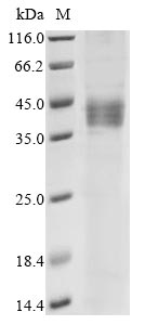 Recombinant Human Receptor for retinol uptake STRA6(STRA6),partial
