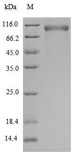 Recombinant Human Receptor tyrosine-protein kinase erbB-2(ERBB2),partial (Active)