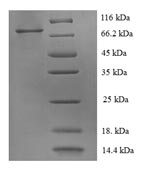 Recombinant Human Receptor tyrosine-protein kinase erbB-2(ERBB2),partial
