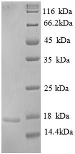 Recombinant Human Replication protein A 14KDA subunit(RPA3),partial