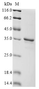 Recombinant Human Retinoic acid-induced protein 3(GPRC5A),partial