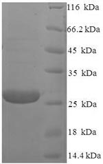 Recombinant Human Retinoschisin(RS1)