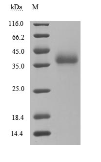 Recombinant Human SARS coronavirus Spike glycoprotein(S) ,partial (Active)