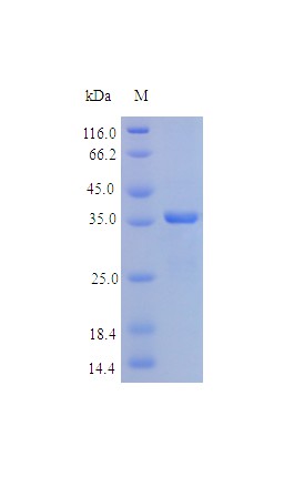 Recombinant Human SPARC protein(SPARC) (Active)
