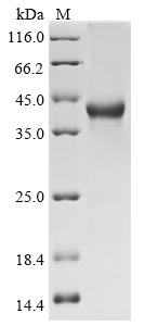 Recombinant Human SPARC-related modular calcium-binding protein 1(SMOC1),Partial