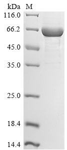 Recombinant Human Schlafen family member 11(SLFN11),partial