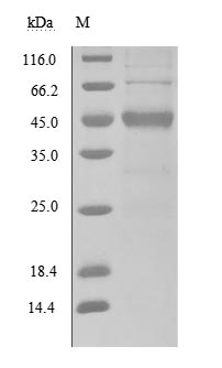 Recombinant Human Secreted and transmembrane protein 1(SECTM1),partial (Active)