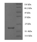 Recombinant Human Secretory phospholipase A2 receptor(PLA2R1) ,partial