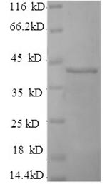 Recombinant Human Selenoprotein P(SEPP1)(U59S,U300S,U318S,U330S,U345S,U352S,U367S,U369S,U376S,U378S)