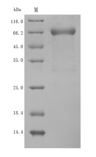 Recombinant Human Semaphorin-4D(SEMA4D),partial (Active)