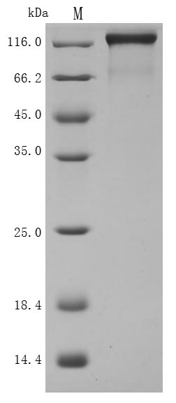 Recombinant Human Semaphorin-4D(SEMA4D),partial (Active)