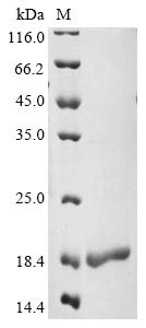 Recombinant Human Serine/arginine-rich splicing factor 3(SRSF3),partial
