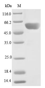 Recombinant Human Serine/threonine-protein phosphatase 2A 55 kDa regulatory subunit B gamma isoform(PPP2R2C)