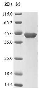 Recombinant Human Serine/threonine-protein phosphatase PP1-gamma catalytic subunit(PPP1CC)