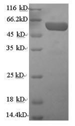 Recombinant Human Serum paraoxonase/arylesterase 1(PON1)