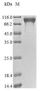 Recombinant Human Signal recognition particle subunit SRP72(SRP72)