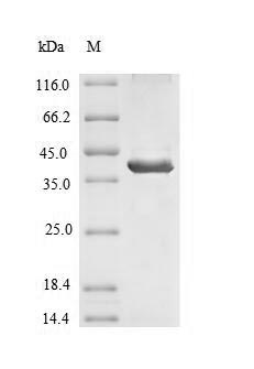 Recombinant Human Signal-regulatory protein beta-1(SIRPB1),partial