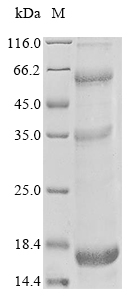 Recombinant Human Sjoegren syndrome nuclear autoantigen 1(SSNA1)