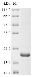 Recombinant Human Sodium channel protein type 1 subunit alpha(SCN1A),partial