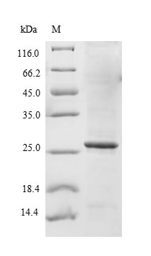 Recombinant Human Sodium-dependent phosphate transport protein 2B(SLC34A2),partial